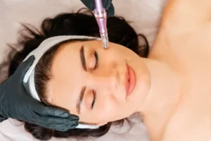 Microneedling Device | Bare N Beautiful in Anderson, SC