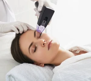 Woman Taking RF Microneedling Treatment | Bare N Beautiful in Anderson, SC