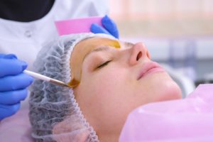 Chemical Peels Costs Types Risks and Recovery